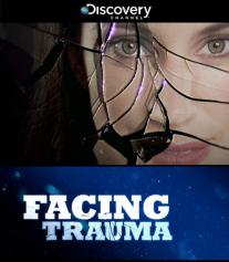 Facing Trauma